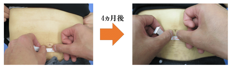 腹直筋お喜びの声　金町　整体