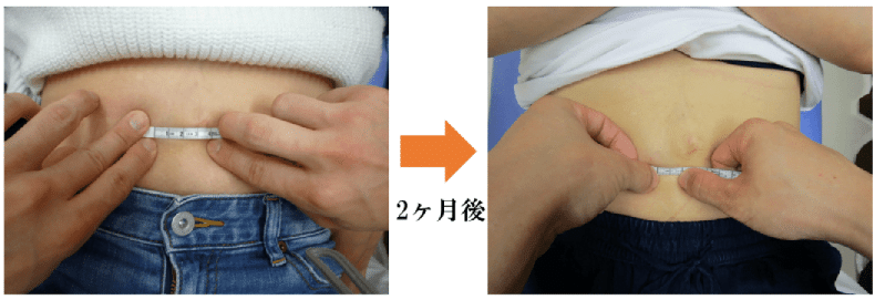 腹直筋お喜びの声　金町　整体