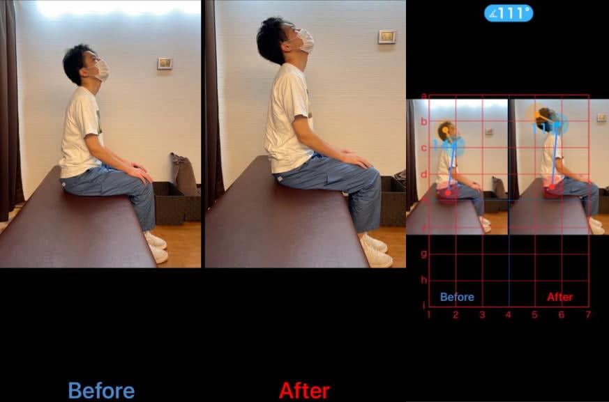 AI姿勢診断で可視化