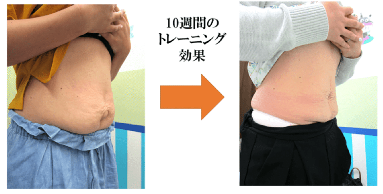 腹直筋お喜びの声　金町　整体