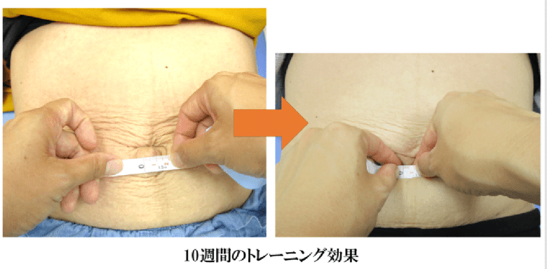 腹直筋お喜びの声　金町　整体