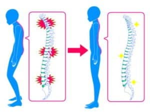【葛飾区金町のやぎはし整体院】金町で「パーキンソン病の腰痛」専門の治療・整体