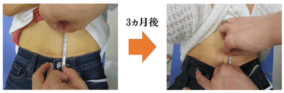 腹直筋お喜びの声　金町　整体