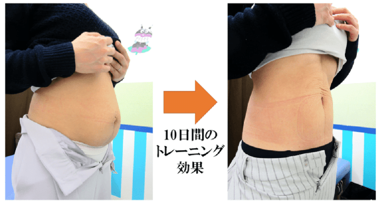 腹直筋お喜びの声　金町　整体