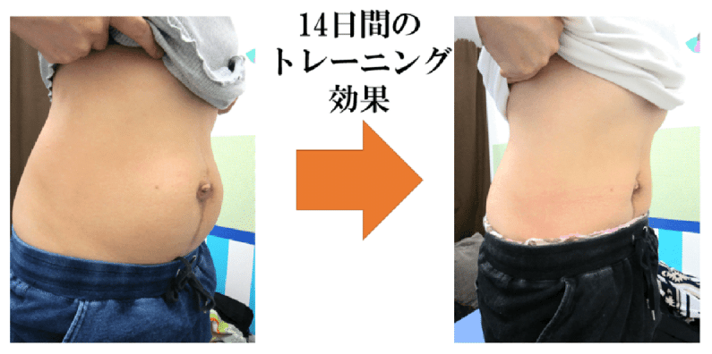 腹直筋お喜びの声　金町　整体