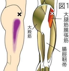 【葛飾区金町のやぎはし整体院】変形性膝関節症と大腿筋膜張筋の関係