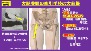 【葛飾区金町のやぎはし整体院】金町で「股関節がコリコリ鳴る　（弾発股）」専門の整体