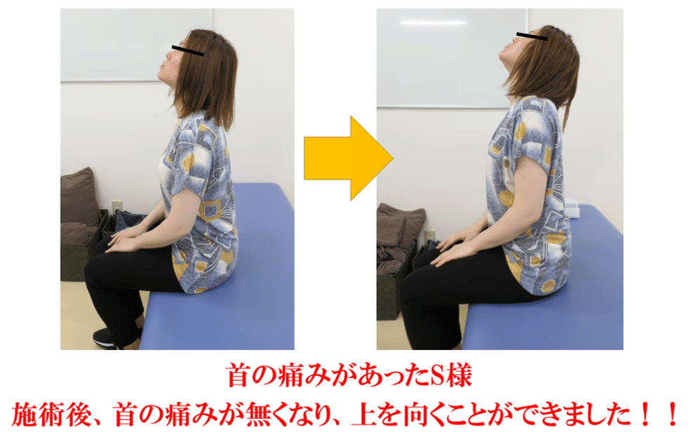 頚椎の治療の結果