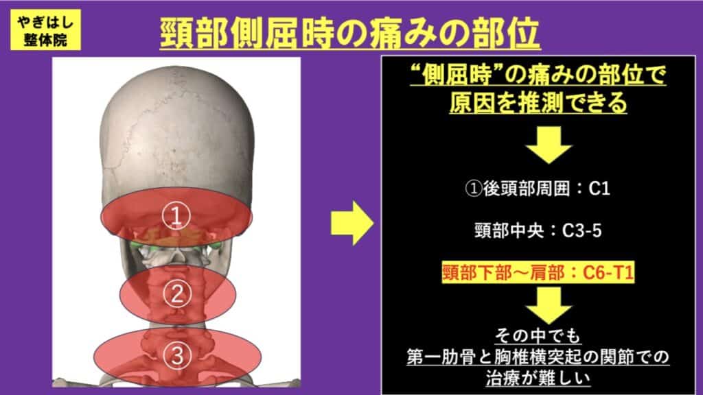 首の関節への治療４