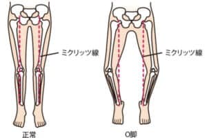 【葛飾区金町のやぎはし整体院】変形性膝関節症と足部の変形の関係