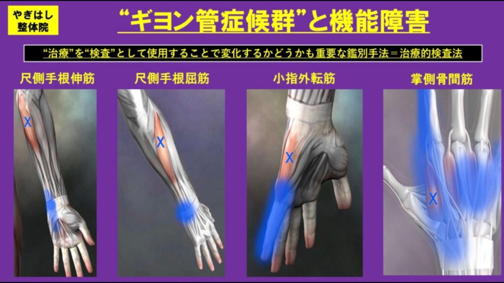 【葛飾区金町のやぎはし整体院】金町で「膝の痛み」専門の整体