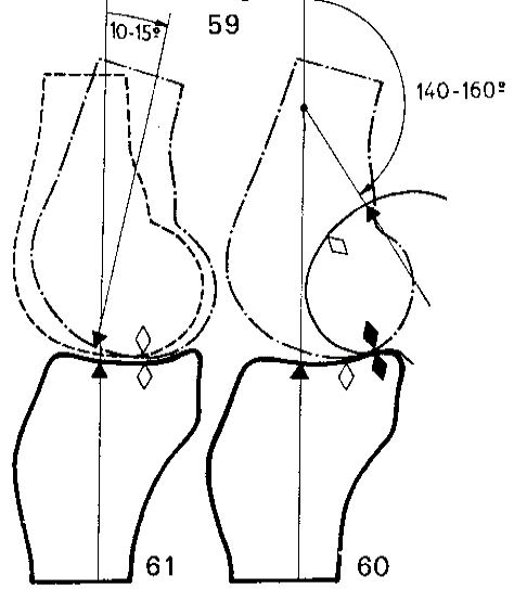 横から見た膝の関節面の動き