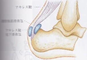 【葛飾区金町のやぎはし整体院】金町で「アキレス腱周囲炎」専門の整体