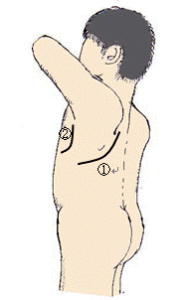 【葛飾区金町のやぎはし整体院】金町で「肺がん手術後の背中や胸の痛み」専門の整体