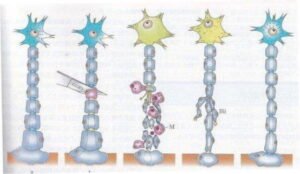 【葛飾区金町のやぎはし整体院】末梢神経障害・末梢神経損傷