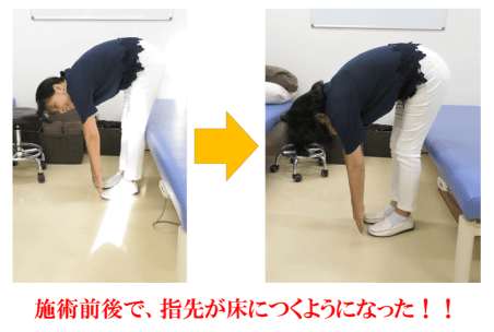 腰痛治療の比較写真2