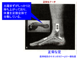 【葛飾区金町のやぎはし整体院】ひざの痛みの治療・整体　扁平足を治すことで膝の痛みを劇的に改善！