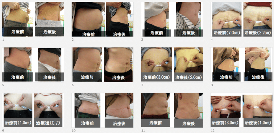 治療前後の比較