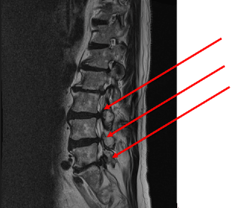 レントゲン写真