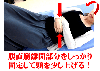 腹直筋離開トレーニング