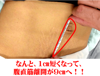 腹直筋トレーニング