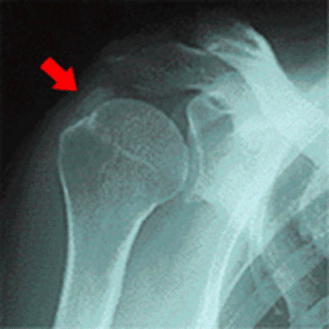 レントゲン写真