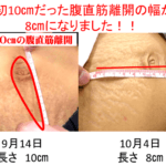 【葛飾区金町のやぎはし整体院】腹直筋離開のトレーニングを紹介！