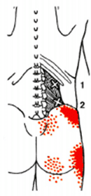 トリガーポイント