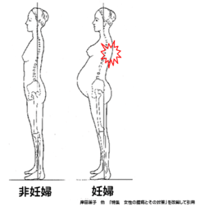 【葛飾区金町のやぎはし整体院】金町で産前・産後の「背中の痛み」専門の整体