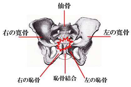 骨盤のイラスト