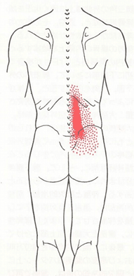 トリガーポイント