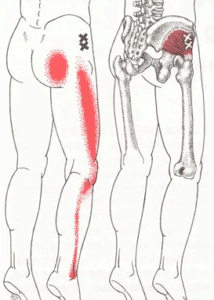 【葛飾区金町のやぎはし整体院】坐骨神経の整体は、筋肉をみる！