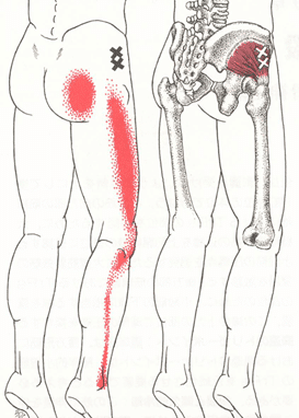 トリガーポイント