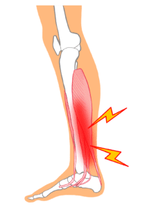 【葛飾区金町のやぎはし整体院】金町で「シンスプリント」専門の整体