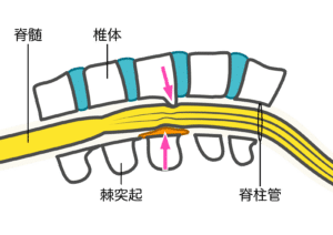 【葛飾区金町のやぎはし整体院】金町で『腰椎椎間板症』専門の治療・整体