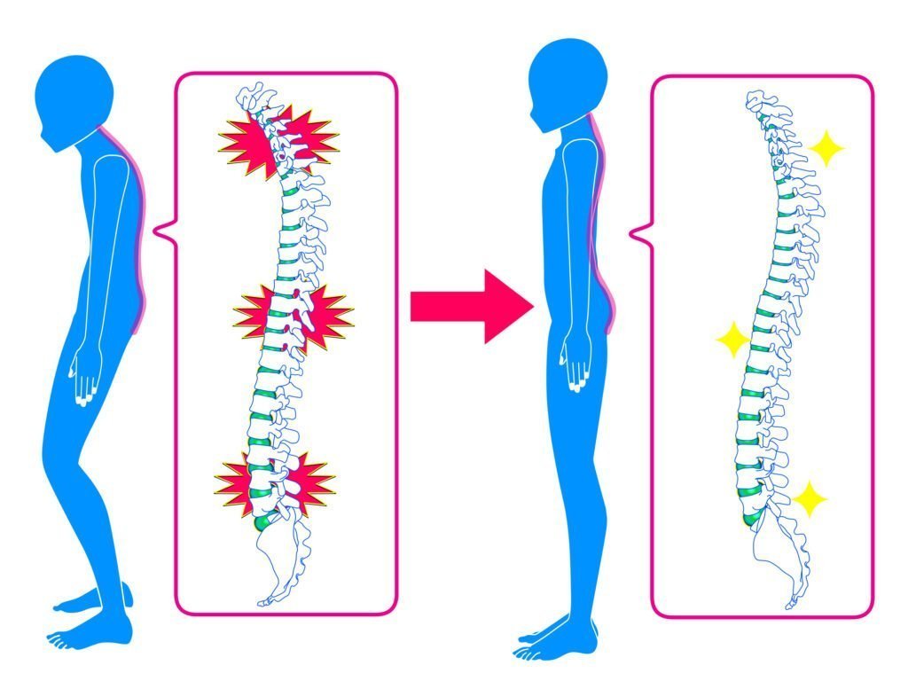 背骨まっすぐ