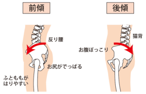 【葛飾区金町のやぎはし整体院】金町で「反り腰」専門の整体院