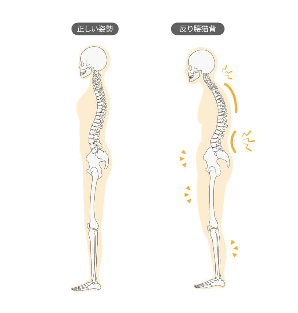 正しい姿勢と反り腰と猫背