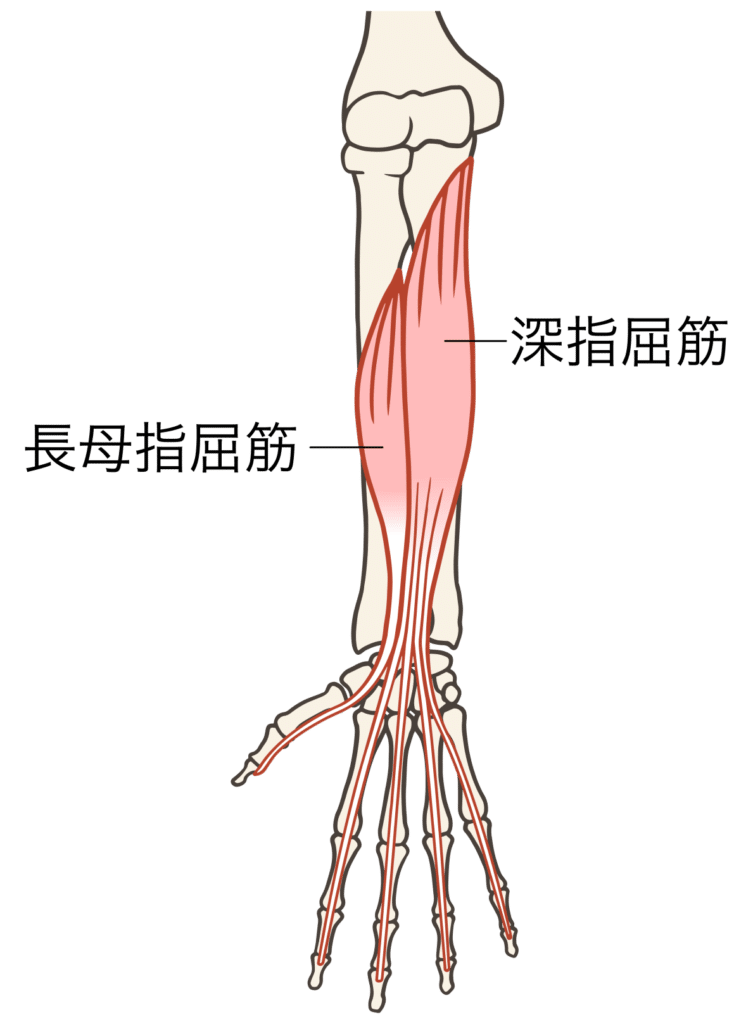 ゴルフ肘（上腕骨内側上顆炎）の原因となる前腕の筋肉2