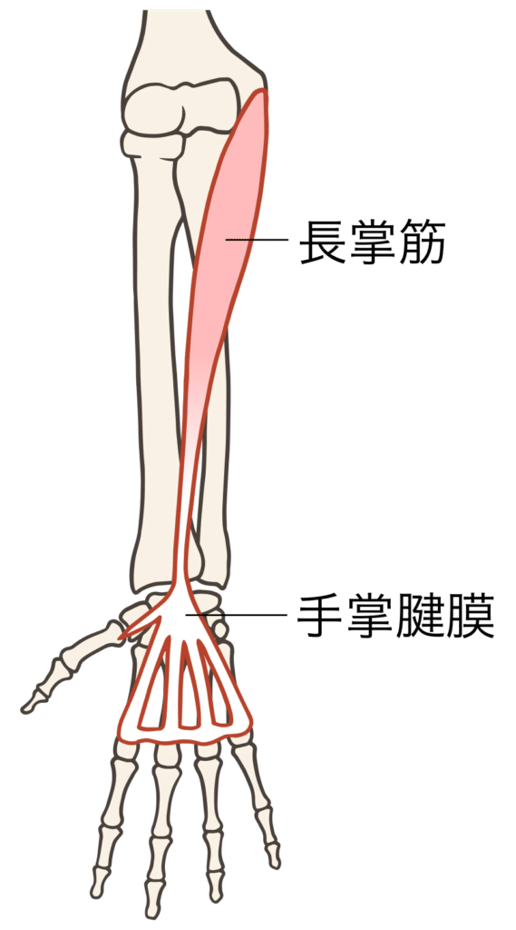 ゴルフ肘（上腕骨内側上顆炎）で治療する筋肉1