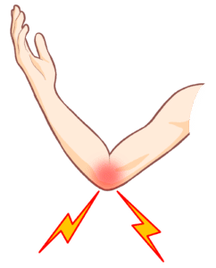 【葛飾区金町のやぎはし整体院】金町でゴルフ肘（上腕骨内側上顆炎）を根本改善する整体