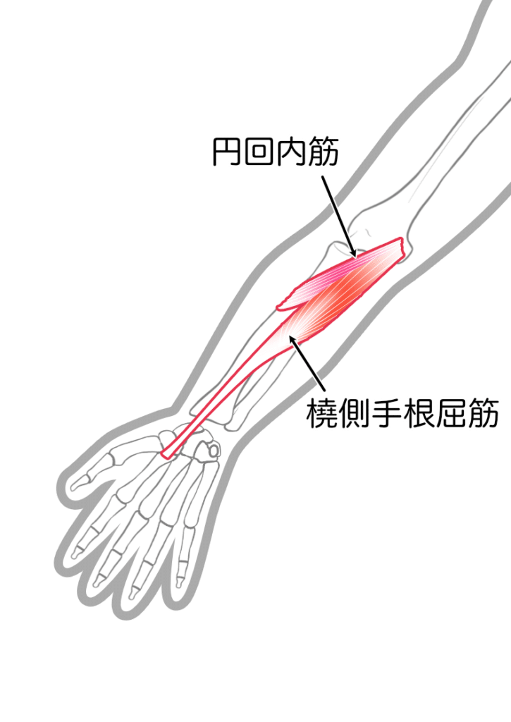 ゴルフ肘（上腕骨内側上顆炎）の原因となる前腕の筋肉3