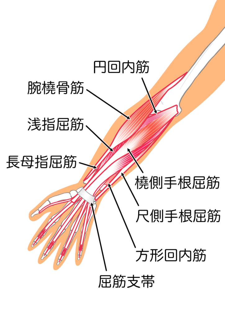 ゴルフ肘（上腕骨内側上顆炎）で治療する筋肉2
