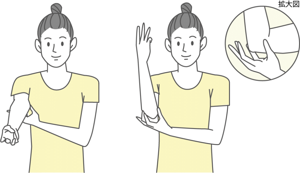 ゴルフ肘（上腕骨内側上顆炎）の前腕の矯正