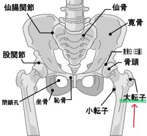 【葛飾区金町のやぎはし整体院】大腿骨大転子疼痛症候群の整体（薬を使わず、手術なしで治す方法）