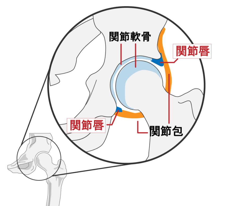 股関節の使いすぎによる鼠径部の痛み