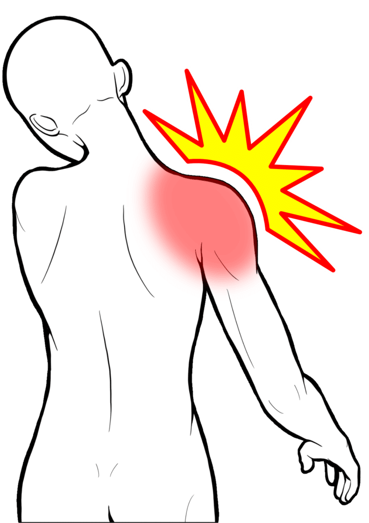 肩から首の痛み