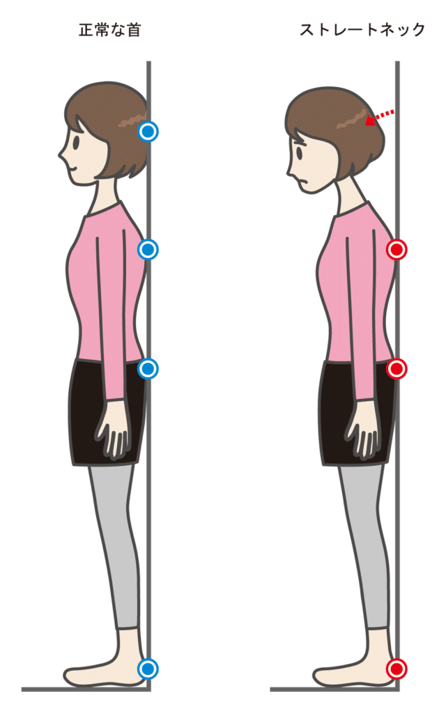 ストレートネック検査