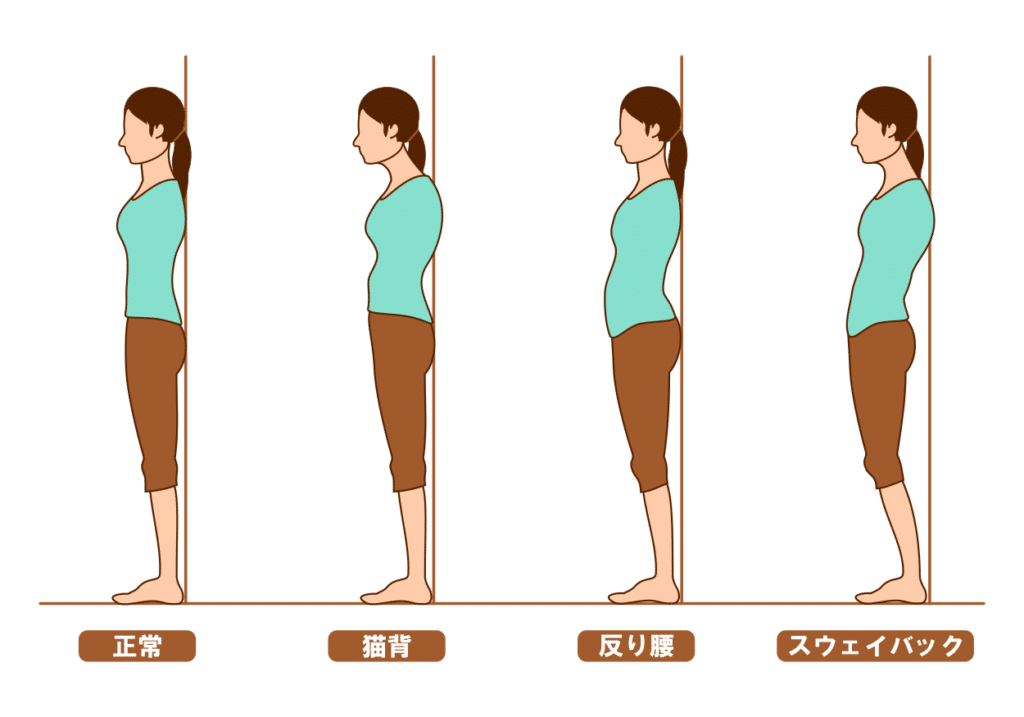 不良姿勢によるストレートネック