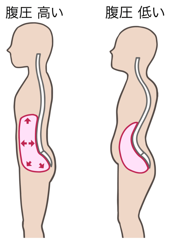 腹圧とストレートネック
